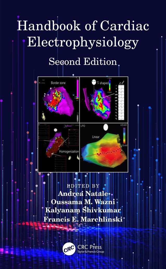 Handbook of Cardiac Electrophysiology by Andrea Natale, Francis E. Marchlinski, Kalyanam Shivkumar, Oussama M. Wazni