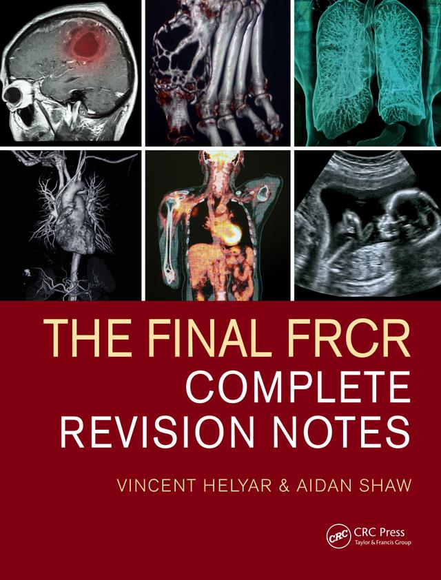 The Final FRCR by Aidan Shaw, Vincent Helyar