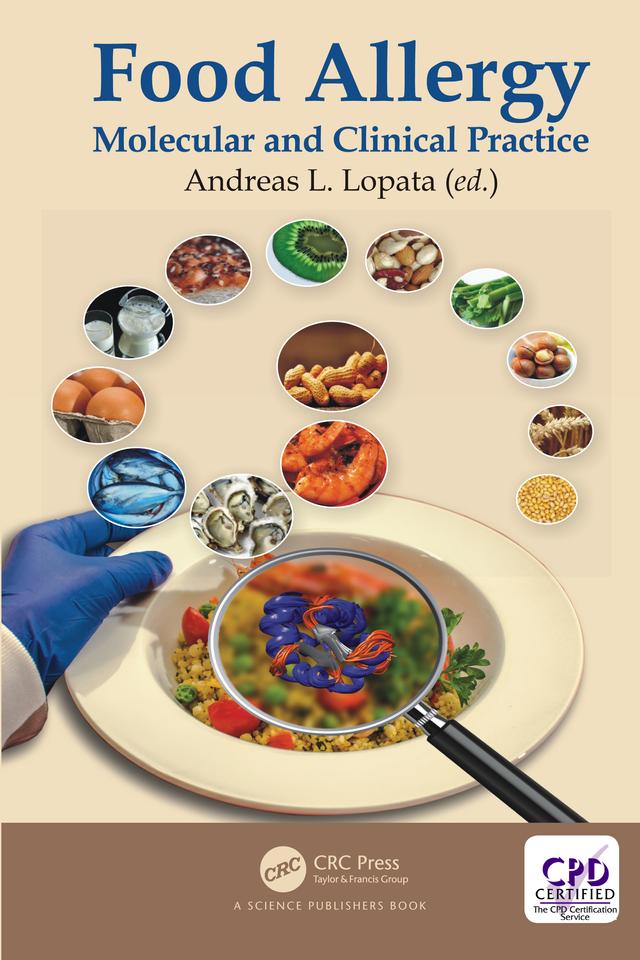 Food Allergy by Andreas L. Lopata