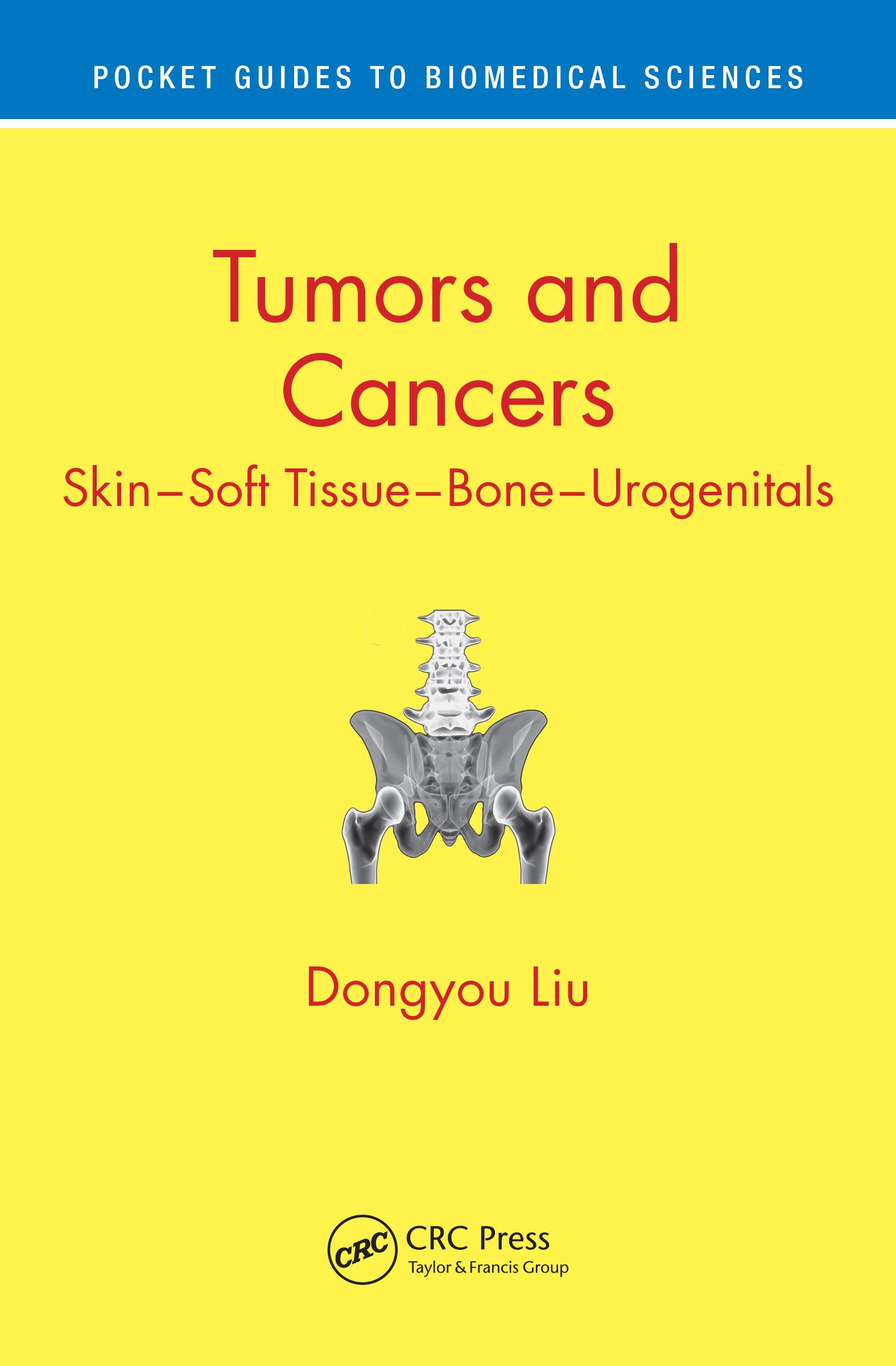 Tumors and Cancers