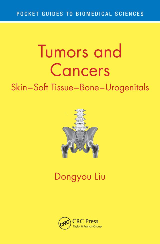 Tumors and Cancers by Dongyou Liu
