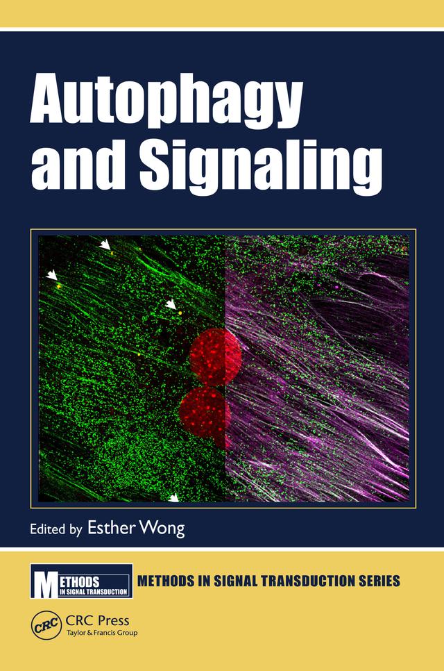 Autophagy and Signaling by Esther Wong