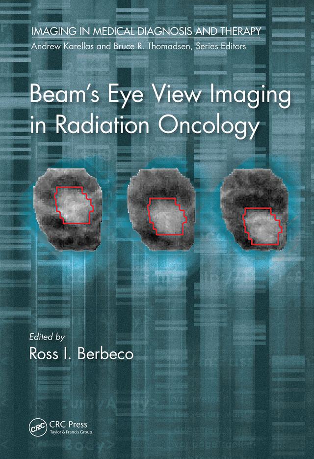 Beam's Eye View Imaging in Radiation Oncology by Ph.D. Berbeco