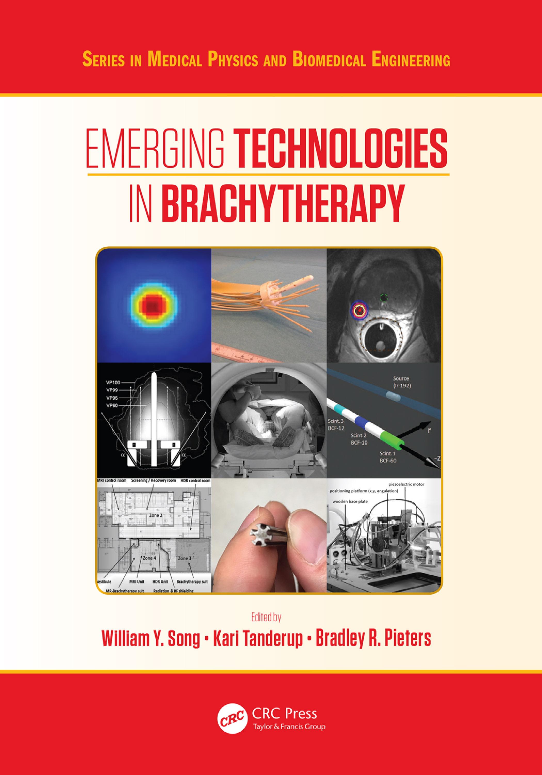 Emerging Technologies in Brachytherapy