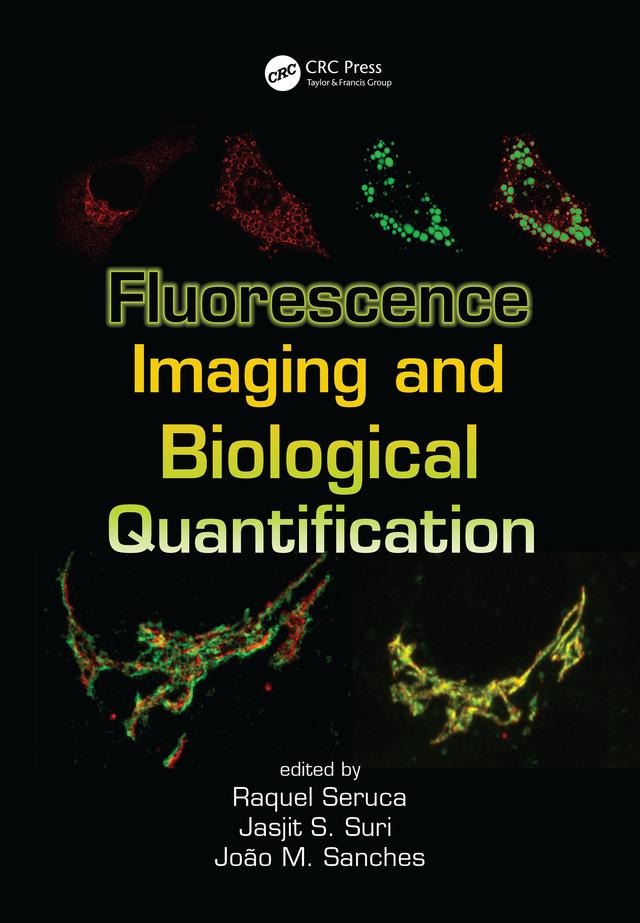 Fluorescence Imaging and Biological Quantification by Jasjit S. Suri, J. Miquel Sanches, Raquel Seruca