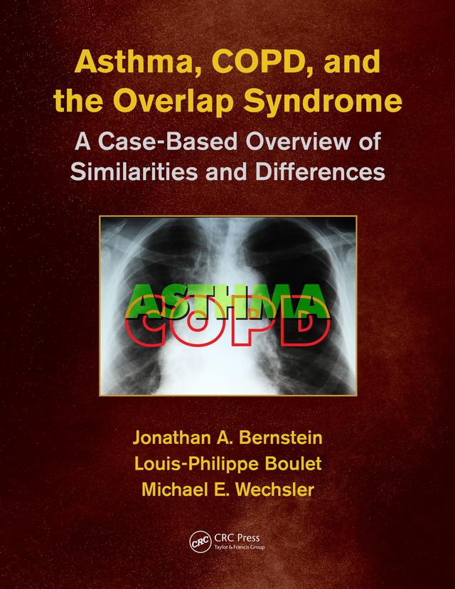 Asthma, COPD, and Overlap by Jonathan A. Bernstein, Louis-Philippe Boulet, Michael E. Wechsler, MD,MMSc