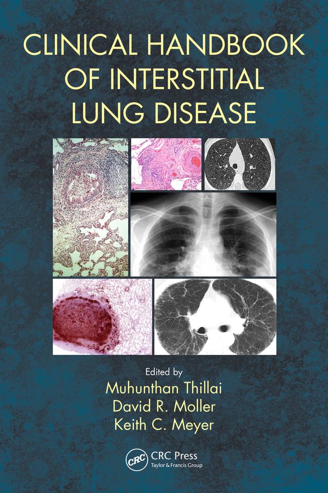Clinical Handbook of Interstitial Lung Disease by David R. Moller, Keith C. Meyer, Muhunthan Thillai