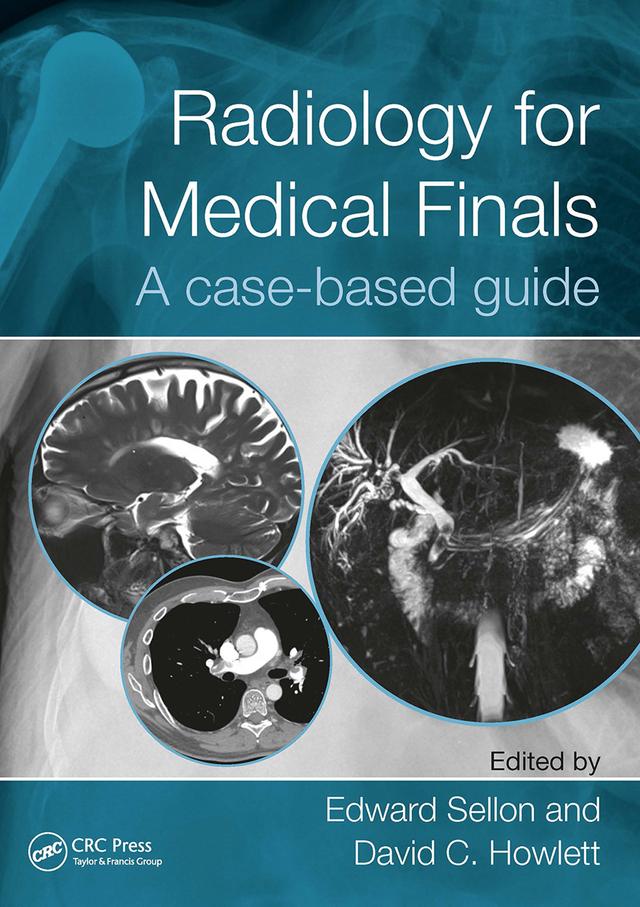 Radiology for Medical Finals by David Howlett, Edward Sellon