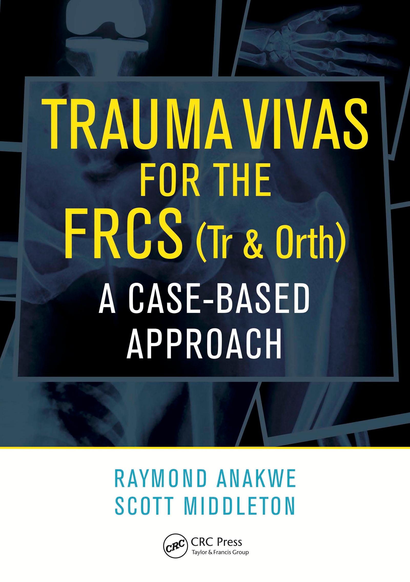 Trauma Vivas for the FRCS