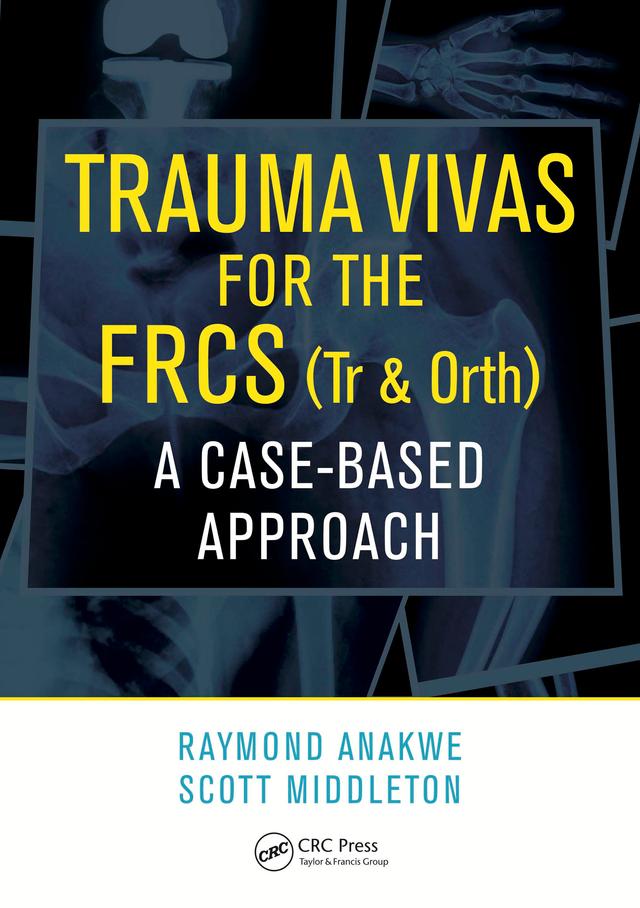 Trauma Vivas for the FRCS by Raymond Anakwe, Scott Middleton
