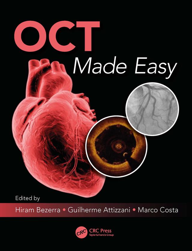 OCT Made Easy by Guilherme F. Attizzani, Hiram G. Bezerra, Marco A. Costa