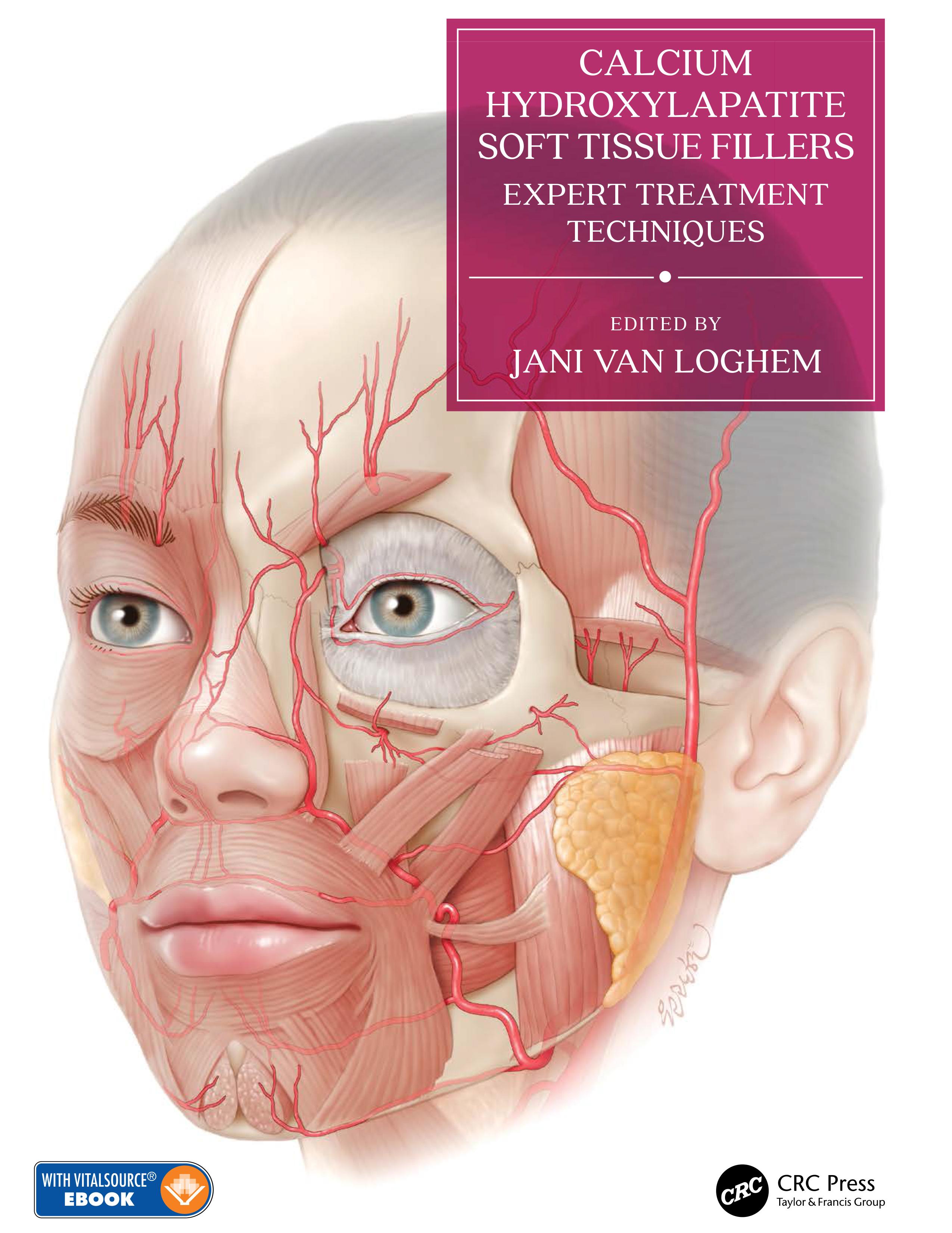 Calcium Hydroxylapatite Soft Tissue Fillers