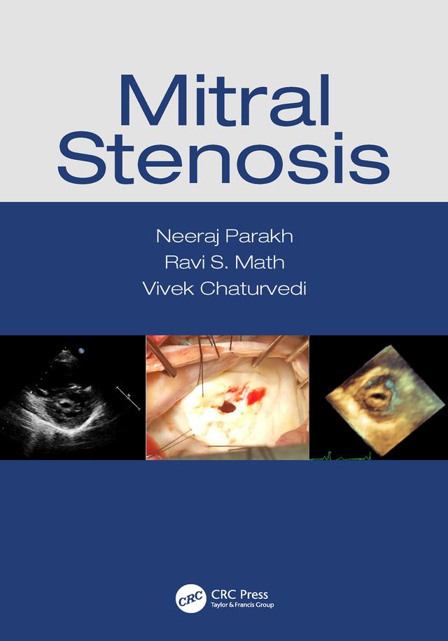 Mitral Stenosis by Neeraj Parakh, Ravi S Math, Vivek Chaturvedi