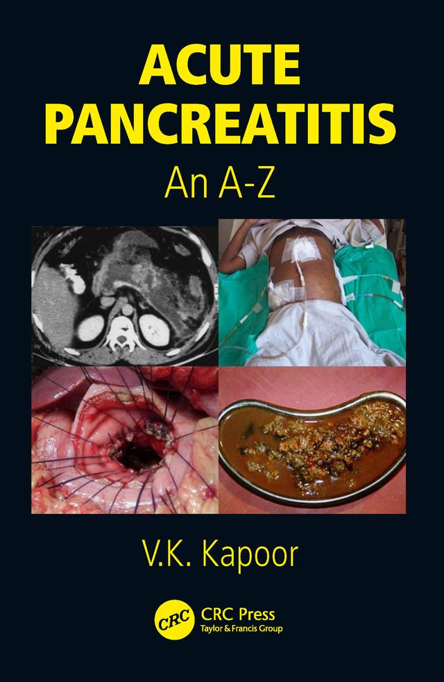 Acute Pancreatitis by V.K. Kapoor