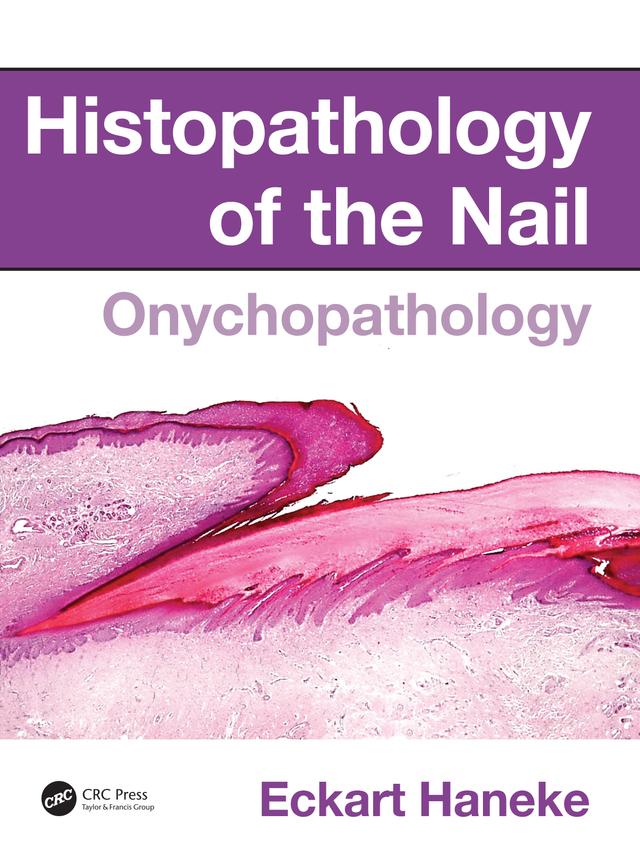Histopathology of the Nail by Eckart Haneke