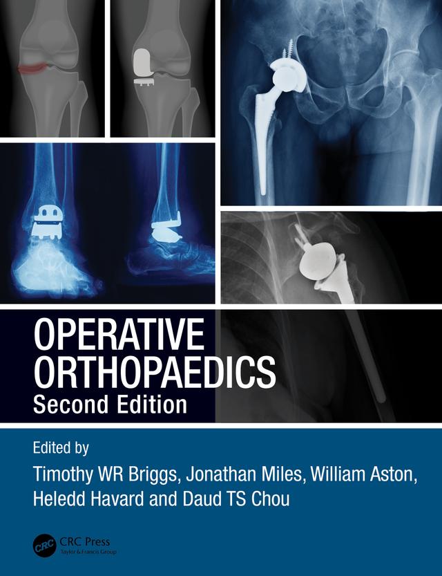Operative Orthopaedics by Daud TS Chou, Heledd Havard, Jonathan Miles, Timothy WR Briggs, William Aston