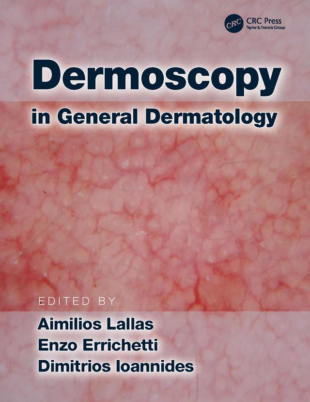 Dermoscopy in General Dermatology by Aimilios Lallas, Dimitrios Ioannides, Enzo Errichetti
