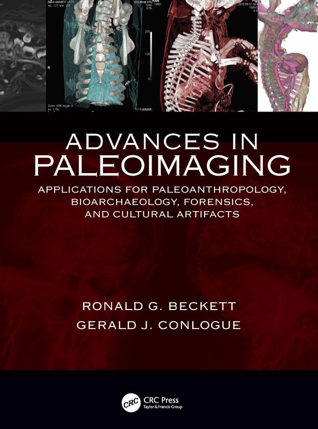 Advances in Paleoimaging by Gerald J. Conlogue, Ronald G. Beckett