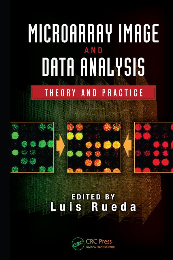 Microarray Image and Data Analysis by Luis Rueda