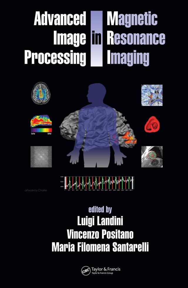 Advanced Image Processing in Magnetic Resonance Imaging by Luigi Landini, Maria Santarelli, Vincenzo Positano