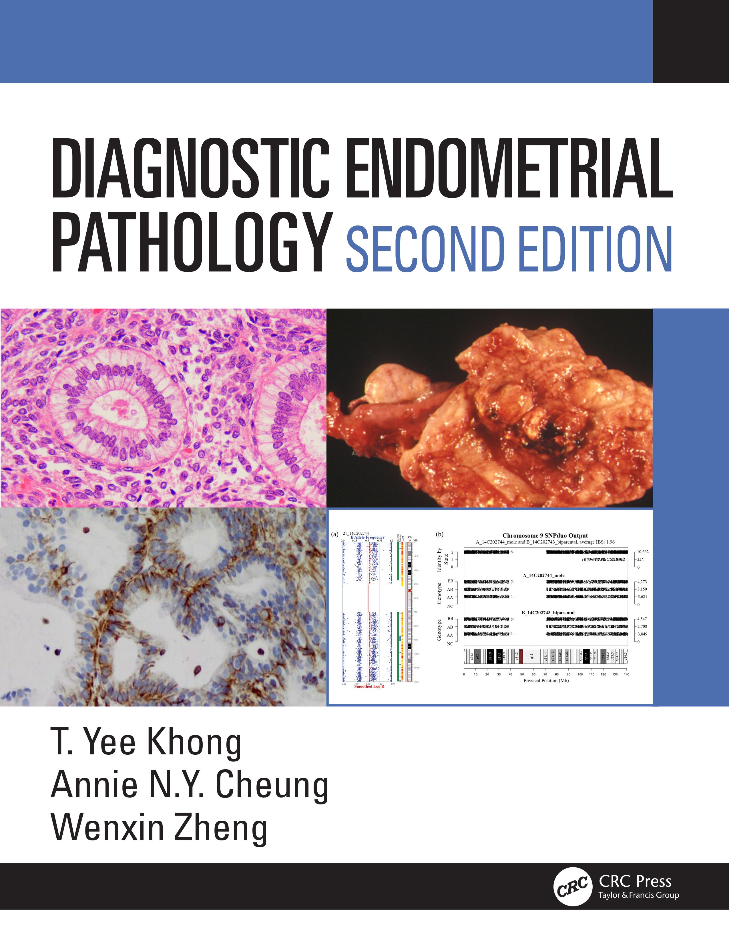 Diagnostic Endometrial Pathology 2E