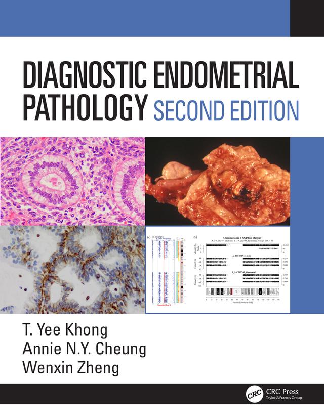 Diagnostic Endometrial Pathology 2E by Annie NY Cheung, Wenxin Zheng, Yee Khong