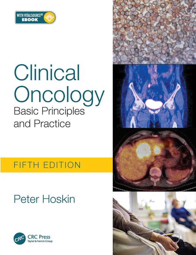 Clinical Oncology by Peter Hoskin