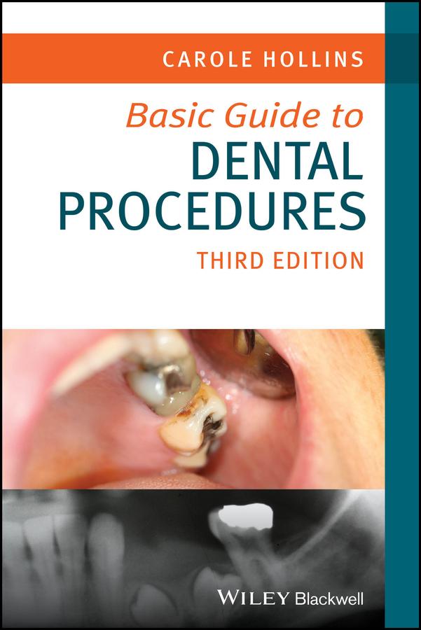 Basic Guide to Dental Procedures by Carole Hollins