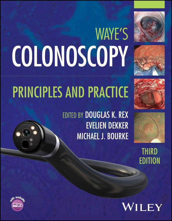 Colonoscopy
