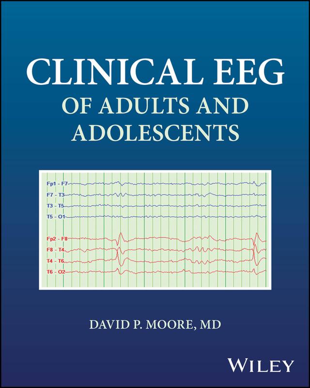 Clinical EEG of Adults and Adolescents by David P. Moore