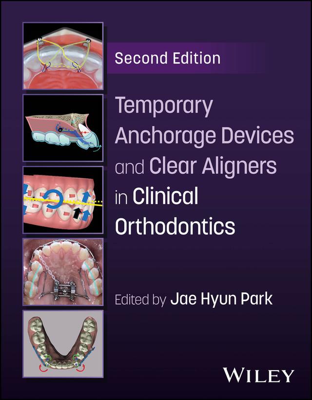 Temporary Anchorage Devices and Clear Aligners in Clinical Orthodontics by Jae Hyun Park