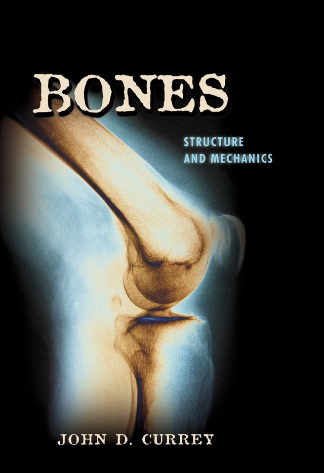 Bones by John D. Currey