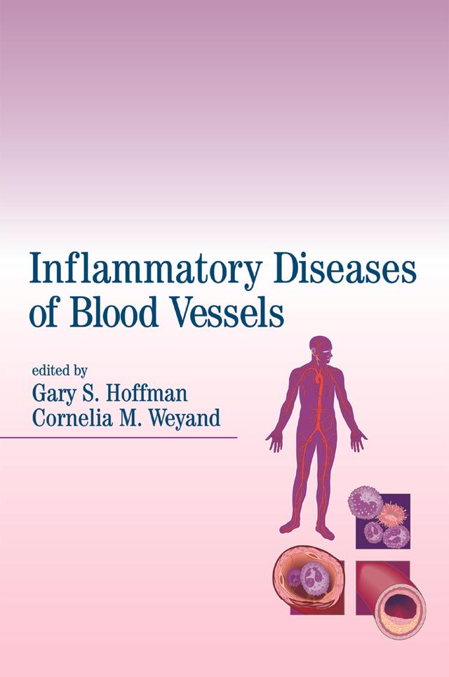 Inflammatory Diseases of Blood Vessels by Cornelia M. Weyand, Gary S. Hoffman
