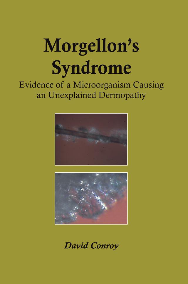 Morgellon's Syndrome by David Conroy