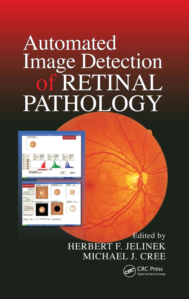 Automated Image Detection of Retinal Pathology by Herbert Jelinek, Michael J. Cree