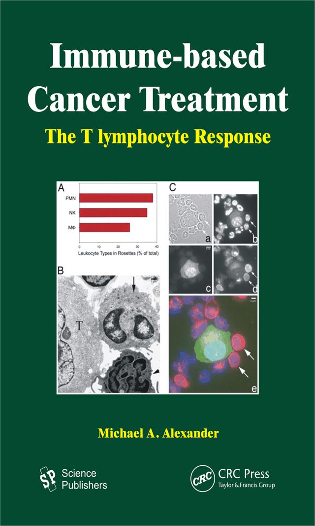 Immune-based Cancer Treatment by Michael A. Alexander