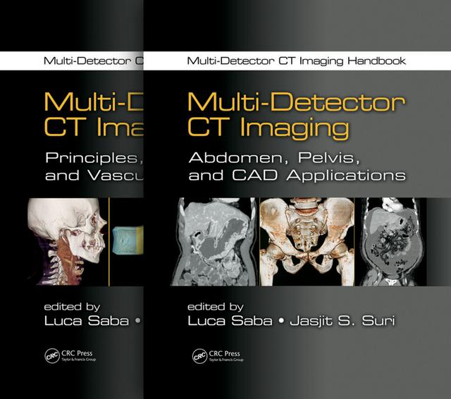 Multi-Detector CT Imaging Handbook, Two Volume Set by Jasjit S. Suri, Luca Saba