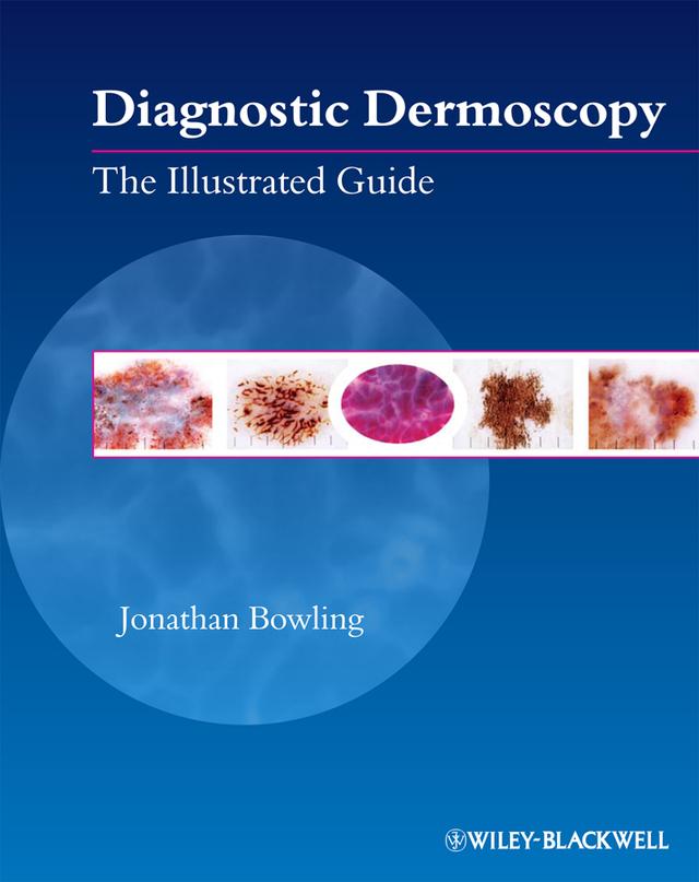 Diagnostic Dermoscopy by Jonathan Bowling