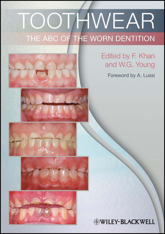 Toothwear