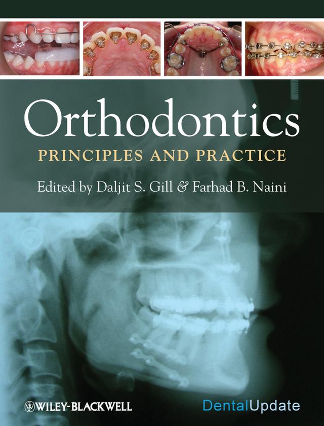 Orthodontics by Daljit S. Gill, Farhad B. Naini