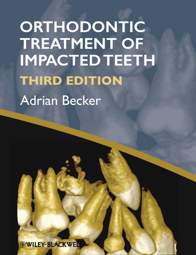 Orthodontic Treatment of Impacted Teeth by Adrian Becker