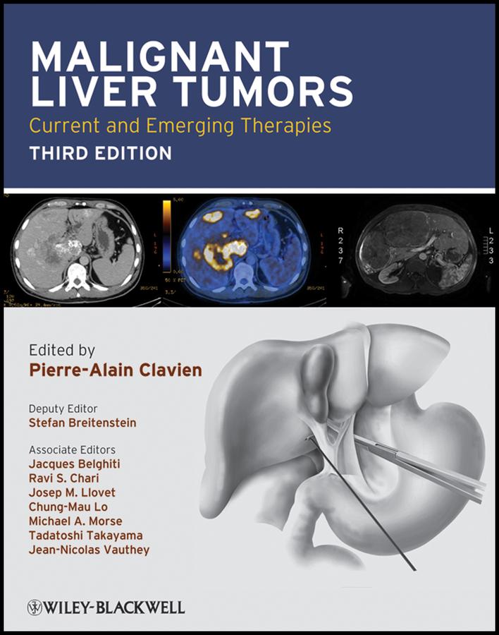 Malignant Liver Tumors