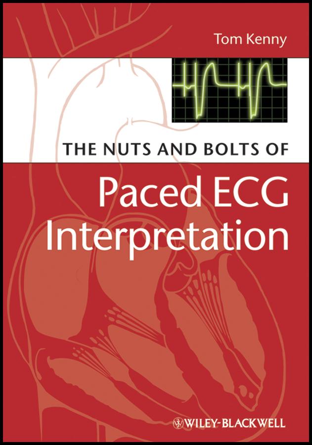 The Nuts and bolts of Paced ECG Interpretation