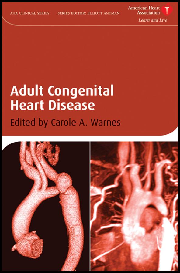 Adult Congenital Heart Disease