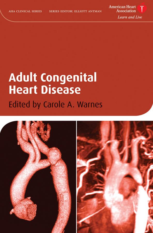 Adult Congenital Heart Disease by Carole A. Warnes