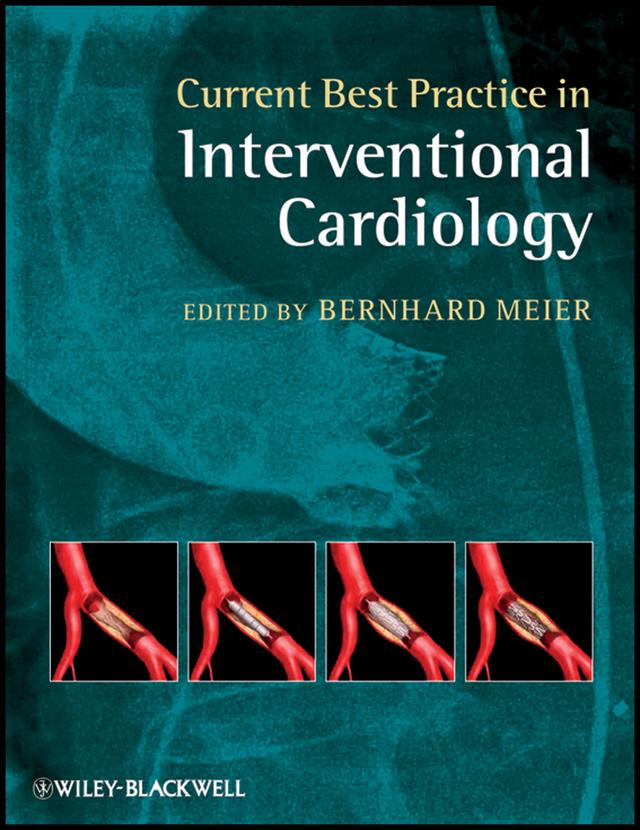 Current Best Practice in Interventional Cardiology by Bernhard Meier
