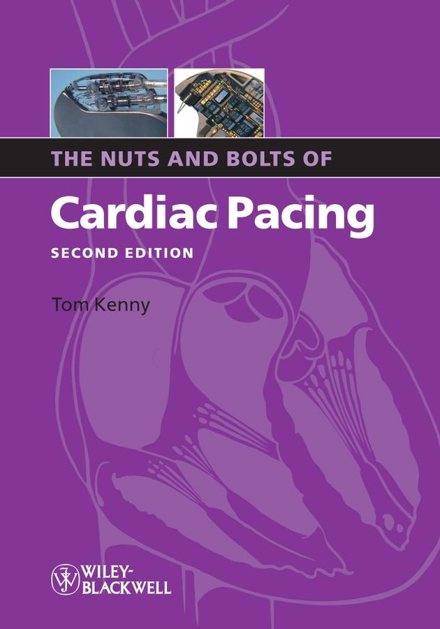 The Nuts and Bolts of Cardiac Pacing by Tom Kenny