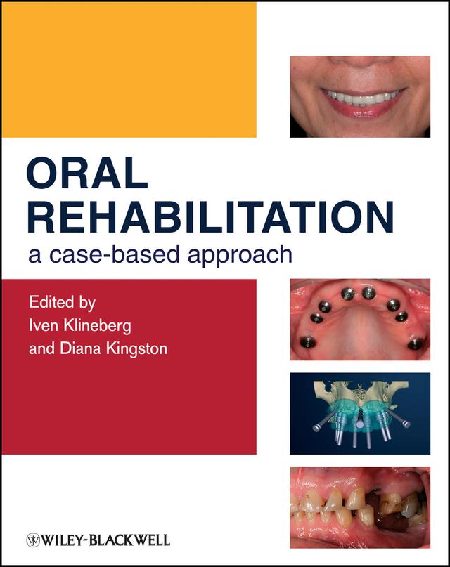 Oral Rehabilitation by Diana Kingston, Iven Klineberg