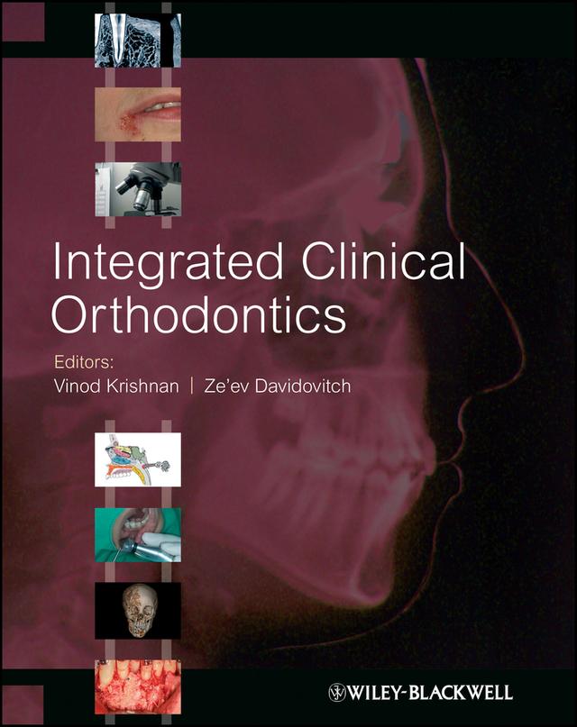Integrated Clinical Orthodontics by Vinod Krishnan, Ze'ev Davidovitch