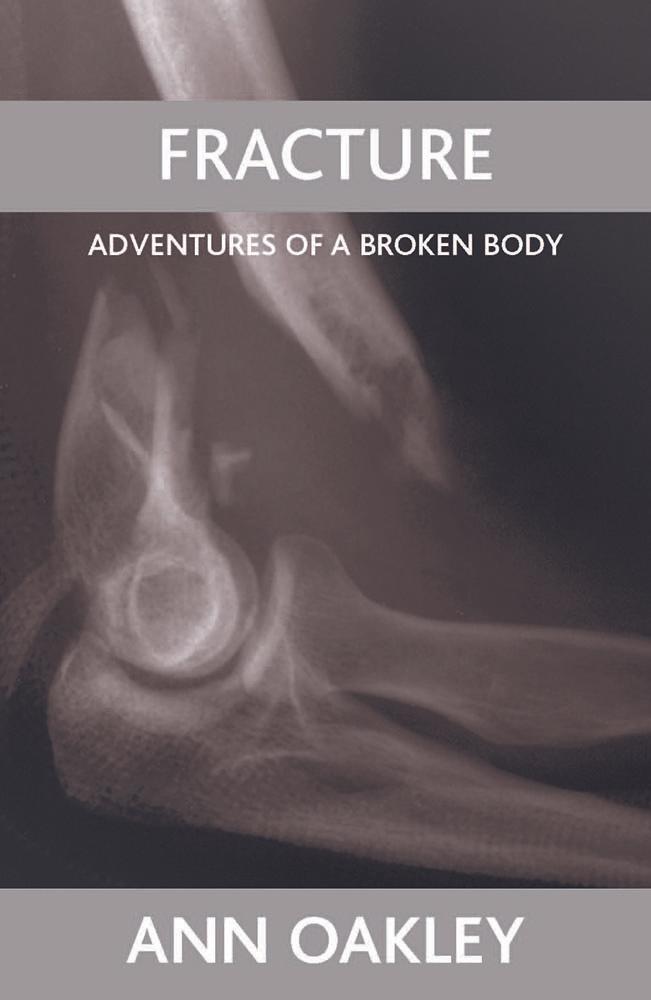 Fracture